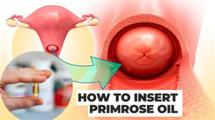 A Guide To Evening Primrose Oil Insertion