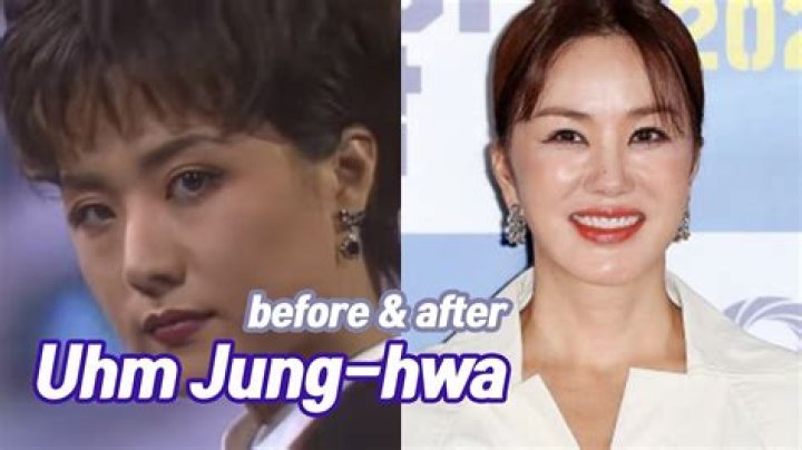 Uhm Jung-hwa's Plastic Surgery Journey And Its Impact